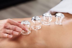 Read more about the article การครอบแก้วและการเดินแก้ว(Cupping and Moving Cupping)คืออะไร